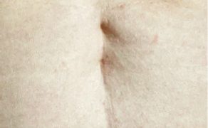 RWP_4_21_Agnieszka_Drozd_TERAPIA_MANUALNA_OBSZAR_BLIZNY_FOT_1
