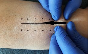 RWP_4_21_Agnieszka_Drozd_TERAPIA_MANUALNA_OBSZAR_BLIZNY_FOT_11