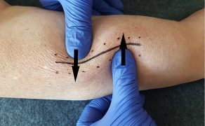 RWP_4_21_Agnieszka_Drozd_TERAPIA_MANUALNA_OBSZAR_BLIZNY_FOT_13