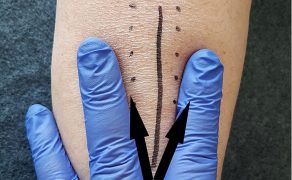 RWP_4_21_Agnieszka_Drozd_TERAPIA_MANUALNA_OBSZAR_BLIZNY_FOT_14