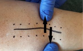 RWP_4_21_Agnieszka_Drozd_TERAPIA_MANUALNA_OBSZAR_BLIZNY_FOT_15