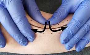 RWP_4_21_Agnieszka_Drozd_TERAPIA_MANUALNA_OBSZAR_BLIZNY_FOT_17
