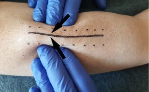 RWP_4_21_Agnieszka_Drozd_TERAPIA_MANUALNA_OBSZAR_BLIZNY_FOT_24