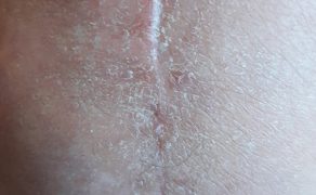 RWP_4_21_Agnieszka_Drozd_TERAPIA_MANUALNA_OBSZAR_BLIZNY_FOT_4
