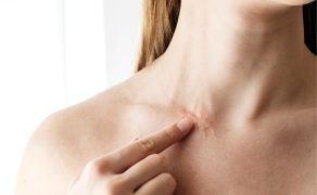 RWP_4_21_Agnieszka_Drozd_TERAPIA_MANUALNA_OBSZAR_BLIZNY_iStock-1281316318