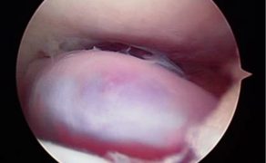 RWP_4_21_Wojciech_Kubasik_ZESPOL_CYKLOPA_FOT_1