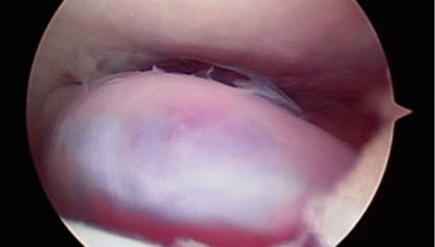 RWP_4_21_Wojciech_Kubasik_ZESPOL_CYKLOPA_FOT_1