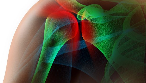 RWP_5-6_21_ARTROPLASTYKA_STAWU_RAMIENNEGO_iStock-459160509