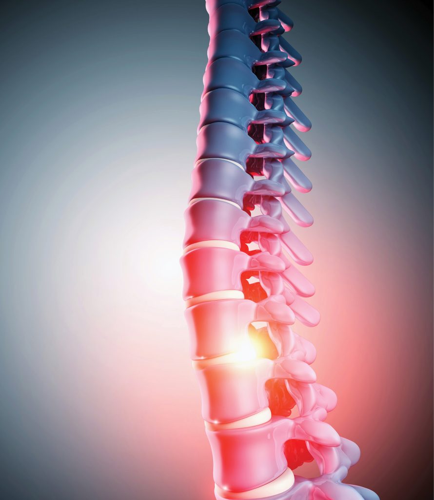 Aktualne spojrzenie na proces usprawniania pacjentów z kręgozmykiem