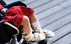 Rehabilitacja pooperacyjna pacjentki z zespołem Kabuki