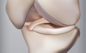 RWP_5_19_ZMIANY_ZWYRODNIENIOWE_STAWU_KOLANOWEGO_iStock-1126716313