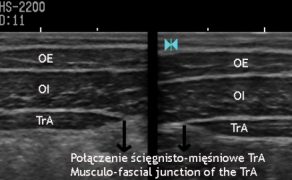 RWP_5_17_Pawel_Linek_USG_MORFOLOGIA_MIESNI_BOCZNEJ_SCIANY_BRZUCHA_RYC_1
