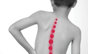 RWP_5_18_PACJENCI_Z_HIPERMOBILNOSCIA_STAWOWA_fot. istockphoto.com