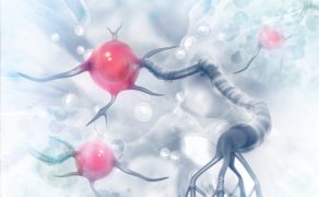 RWP_6_18_OSOBY_Z_CHOROBA_HUNTINGTONA_iStock-1016558882