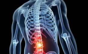 Spondyloartropatia - jak zminimalizować opóźnienie diagnozy i zwiększyć dostęp pacjenta do odpowiedniej terapii?