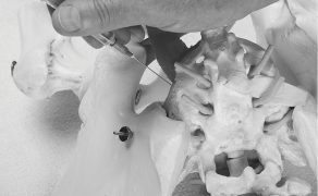 RWP_3_23_Bogumila_Dampc_PRZEWLEKLE_BOLE_MIEDNICY_MNIEJSZEJ_FOT_6