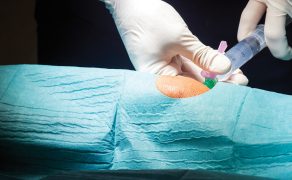 RWP_4_24_Karolina_Mojza_PACJENT_PO_RADIOSYNOWIORTEZIE_iStock-846318730