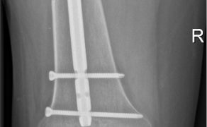 RWP_4_24_Monika_Pizun_DZIALANIA_WOJENNE_W_URAZ_WIELONARZADOWY_FOT_9