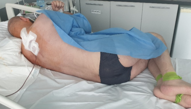 Fizjoterapia w przebiegu leczenia neurochirurgicznego przerzutu nowotworu germinalnego (2)