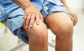 RWP_2_25_Bartosz_Panczyszak_ENDOPROTEZOPLASTYKA_STAWU_KOLANOWEGO_MOZLIWOSCI_FIZJOTERAPII_iStock-2029982114