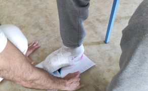 RWP_3_25_FIZJOTERAPIA_OPARZEN_OPIS_PRZYPADKU_CZ_2_FOT_45