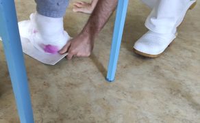 RWP_3_25_FIZJOTERAPIA_OPARZEN_OPIS_PRZYPADKU_CZ_2_FOT_46