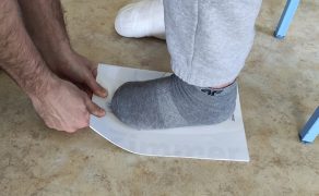 RWP_3_25_FIZJOTERAPIA_OPARZEN_OPIS_PRZYPADKU_CZ_2_FOT_47