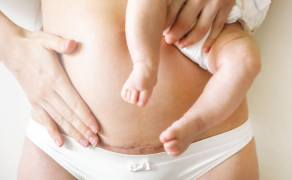 Wiedza kobiet na temat możliwości fizjoterapeutycznych w ciąży i połogu