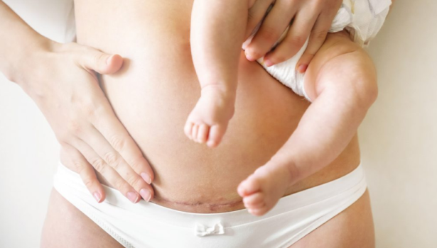 Wiedza kobiet na temat możliwości fizjoterapeutycznych w ciąży i połogu